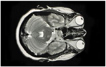 CT scan