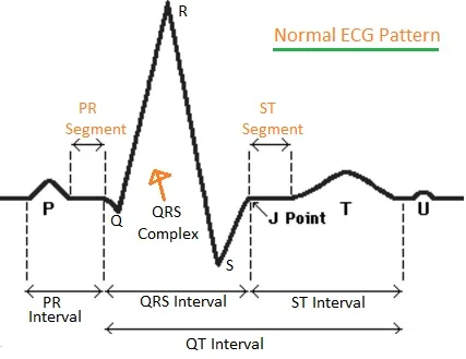 ECG test waveforms